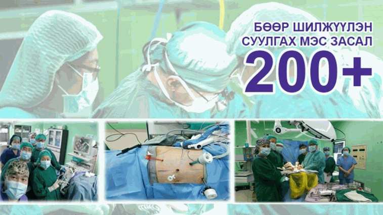 Organ transplant project